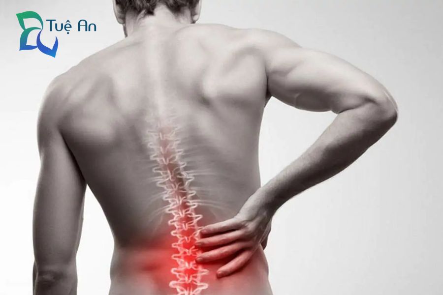đau thắt lưng là bệnh gì