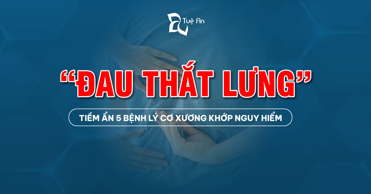 Đau thắt lưng - Tiềm ẩn 5 bệnh lý cơ xương khớp nguy hiểm bạn phải biết