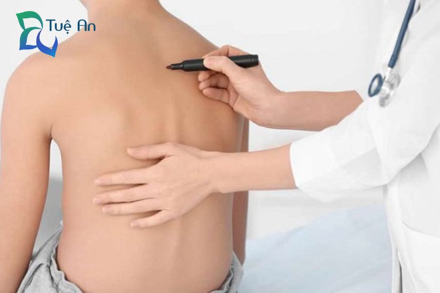 phòng ngừa gù lưng ở trẻ