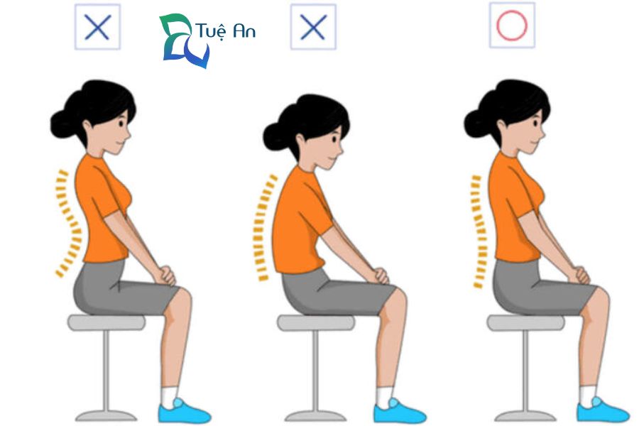 gù lưng ở trẻ em