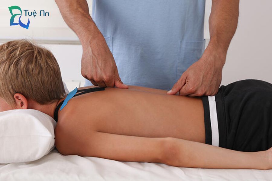 vật lý trị liệu gù lưng ở trẻ