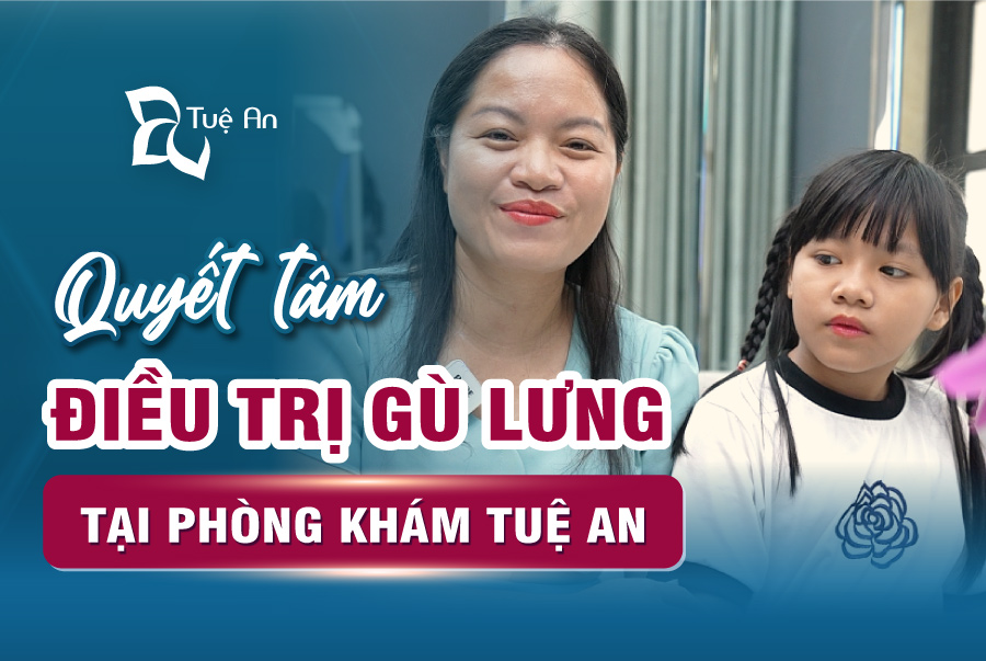 cách chữa bệnh gù lưng ở trẻ em