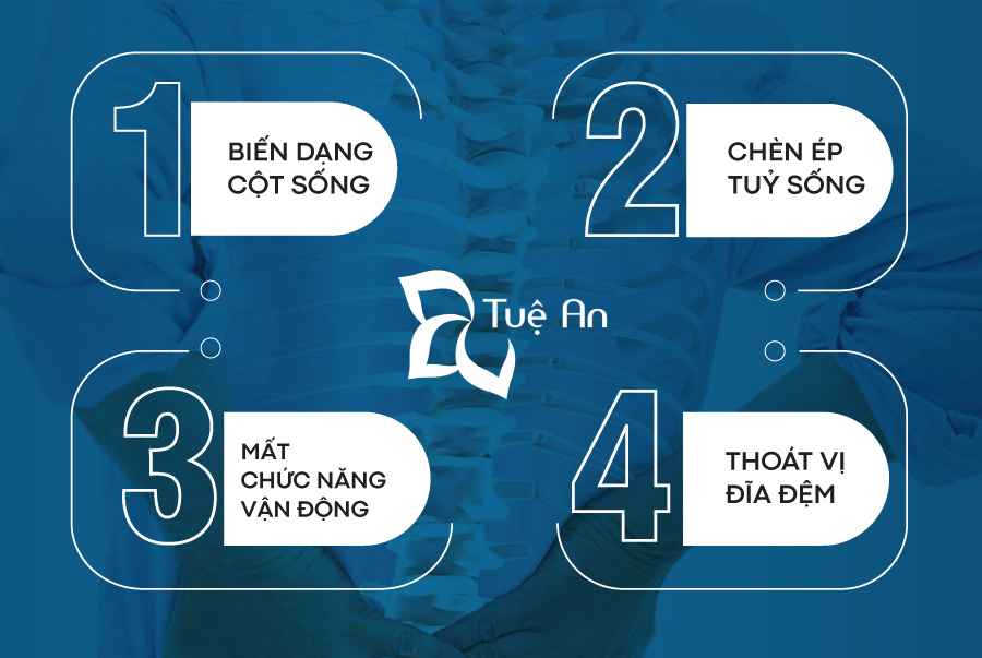 triệu chứng thoái hóa cột sống thắt lưng