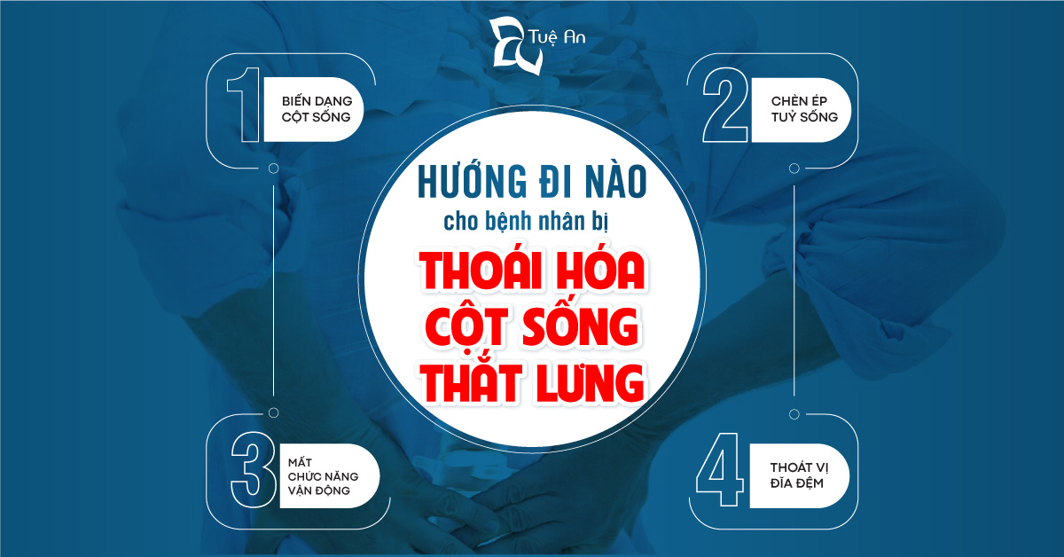 Hướng đi nào cho bệnh nhân bị thoái hóa cột sống thắt lưng