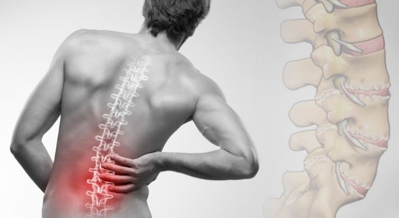 Thoái hóa cột sống thắt lưng