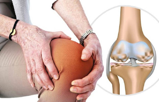 thoái hóa khớp gối có chữa được không