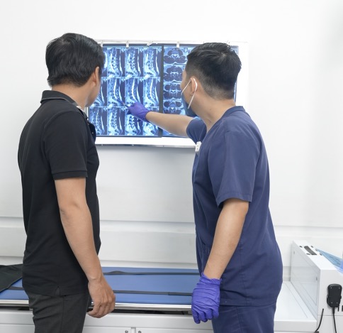 thoát vị đĩa đệm nên làm gì